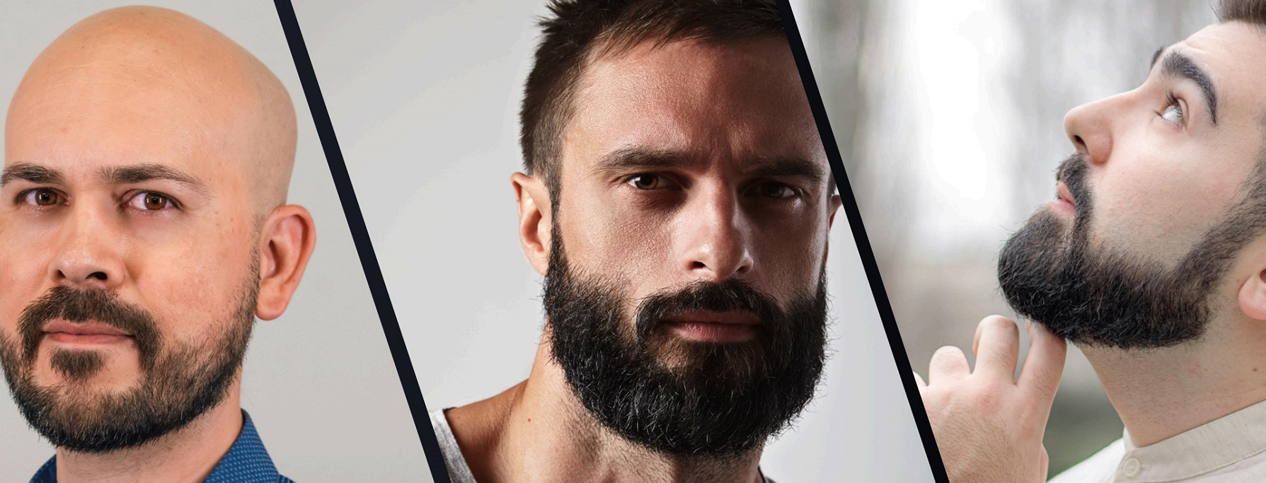 beard hair transplant in islamabad pakistan